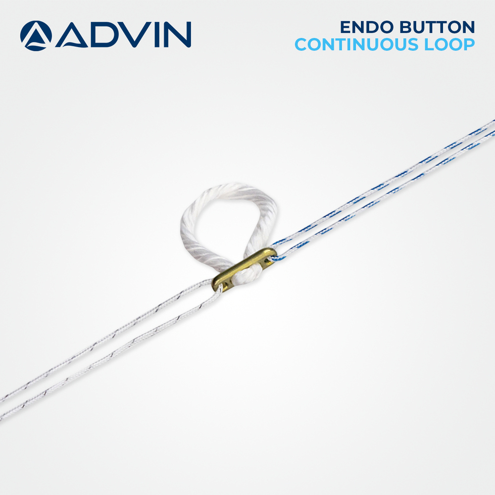 Endo Button Continuous Loop - Size L 12mm X W 2mm X H 1.5mm | Non-traditional Acl Graft Attachment Device For Orthopedic Surgery