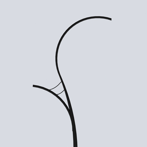 -03 Bracket - Color: Black