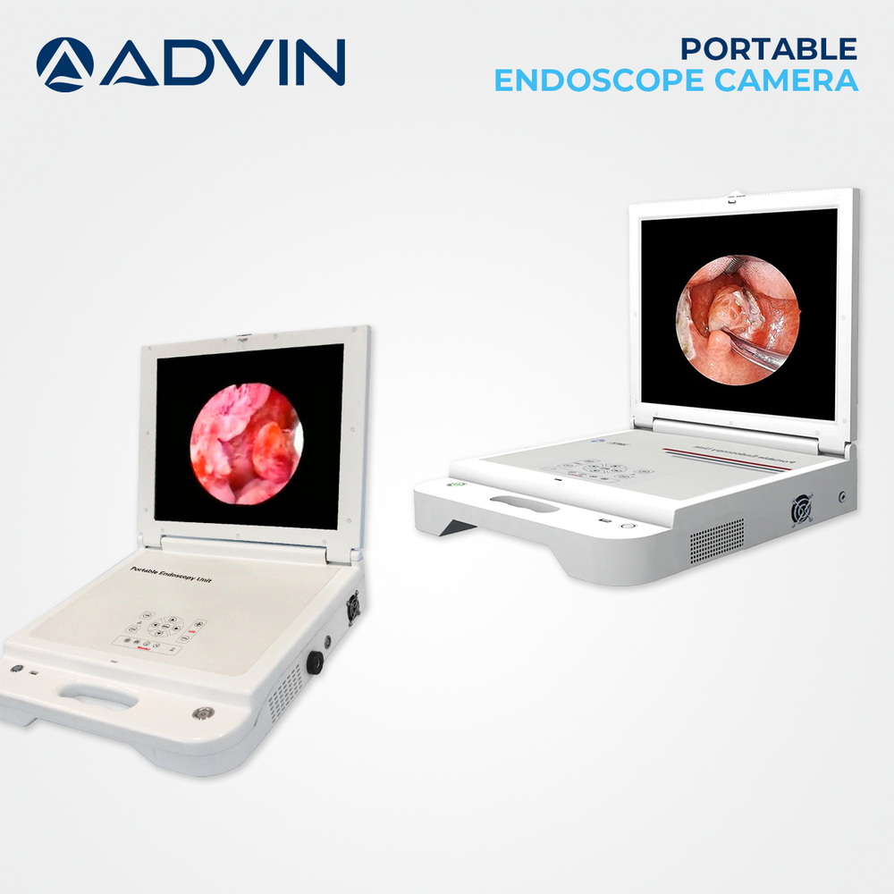 Urology Portable Endoscope Camera Advin
