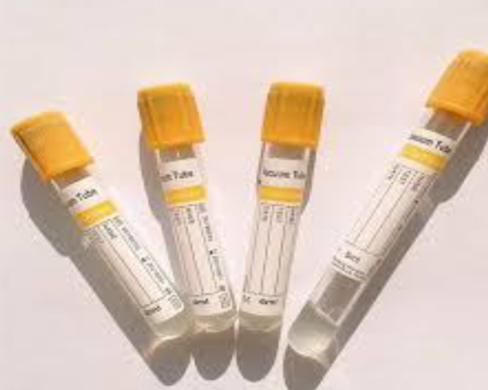 4Ml Separate Gel And Clot Yellow Cap - Color: Different Availabe