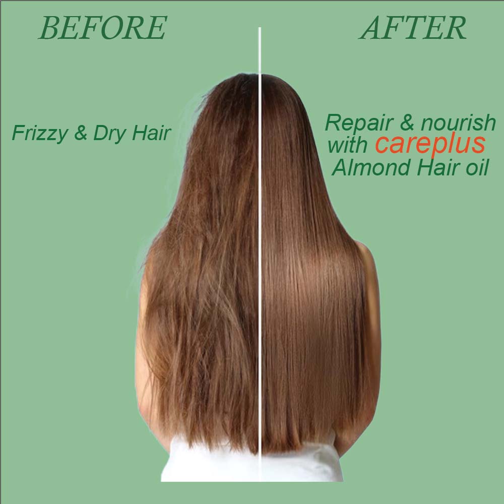100ml Amla Hair Oil Bottle - Battery Life: 24 Months