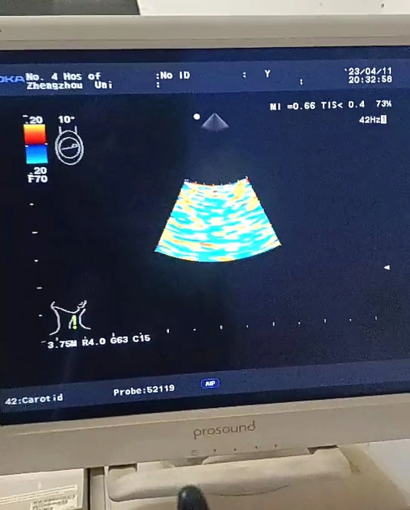 Aloka UST-52119S Ultrasound Transducer