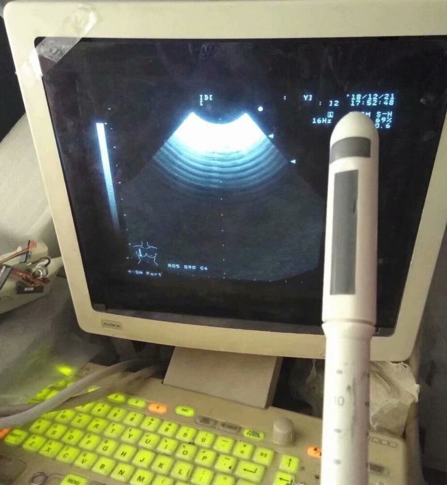 Aloka UST-672-5-7.5 Ultrasound Transducer