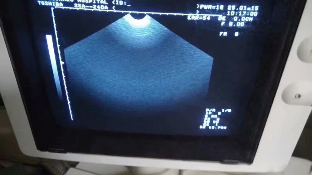 Aloka Ust-984-5 Ultrasound Transducer - Color: As Per Requirement