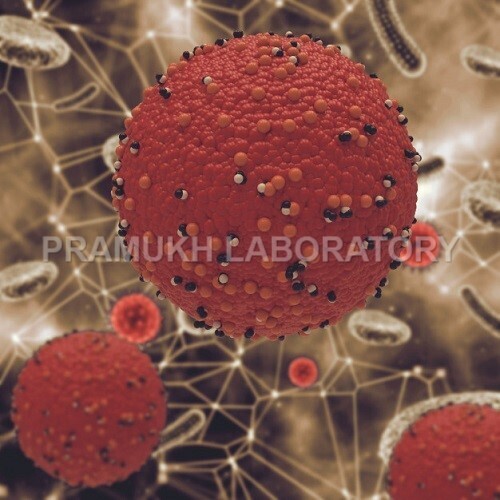 Salmonella Newbrunswick Testing Services