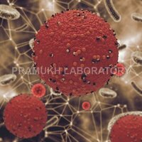 Salmonella Newbrunswick Testing Services