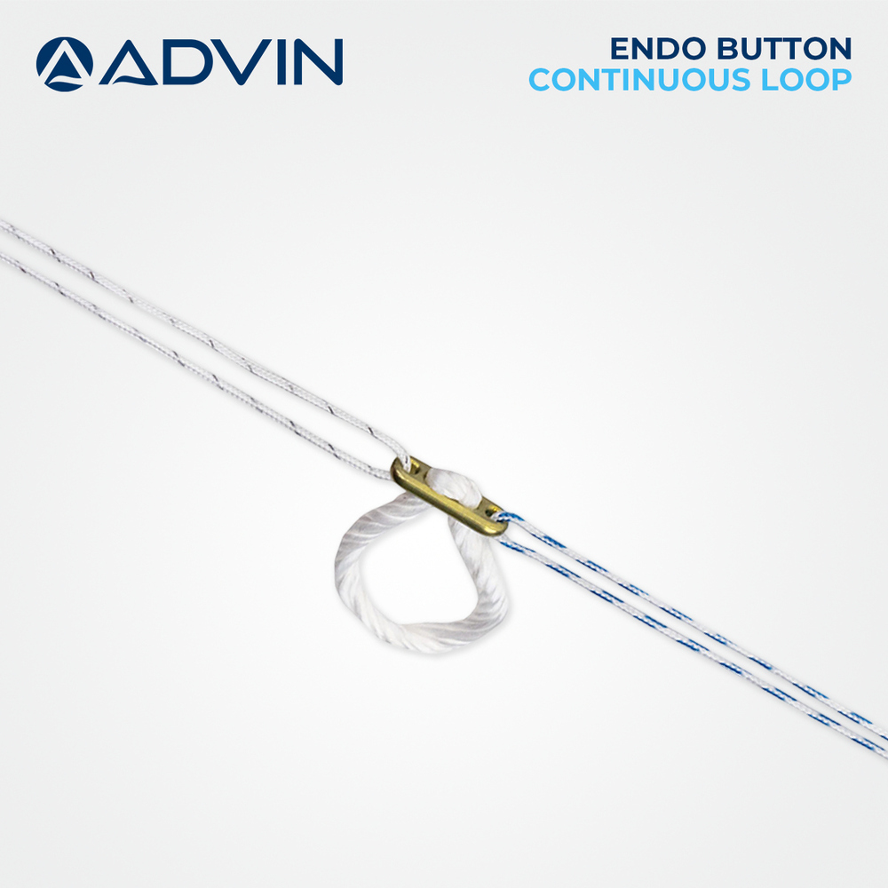 Endobutton, ACL Fixation