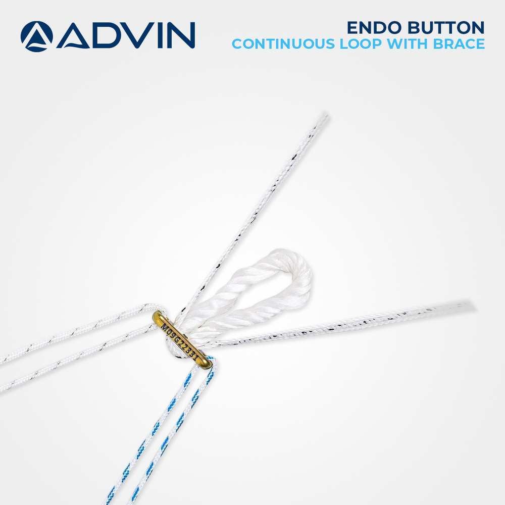 EndoButton Implant Alternative - Durable Material, Flexible Loop Design | Smooth Graft Passage, Secure Fixation for ACL/PCL Reconstruction