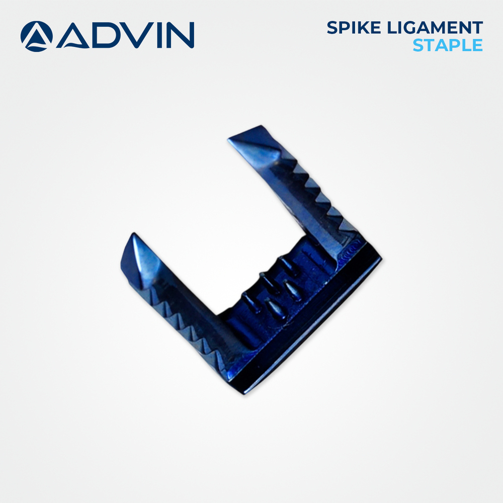 Spiked Ligament Staple