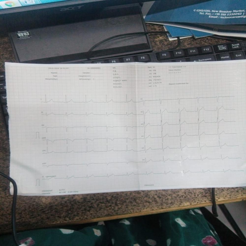 12 Channel Ecg Machine - 12 Leads, Color Lcd Display, Thermal Printer, Rechargeable Battery, Usb & Sd Card Storage, Digital Signal Processing | Ideal For Hospital And Clinic Diagnosis