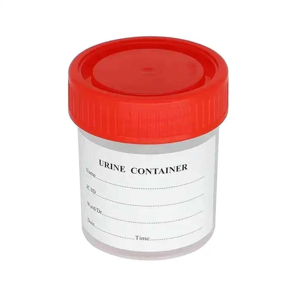 30ml Urine Container - Application: Clinical Purpose