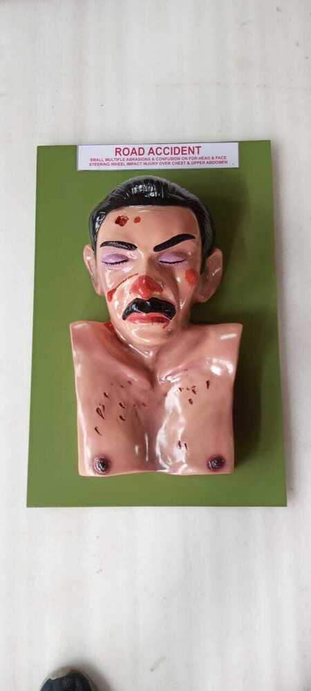 Road Accident Model - Application: Medical Use