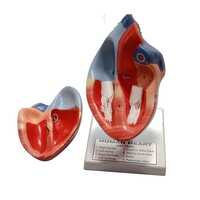 Human Heart Model