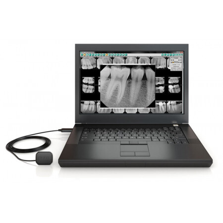 Dexis Digital X-Ray