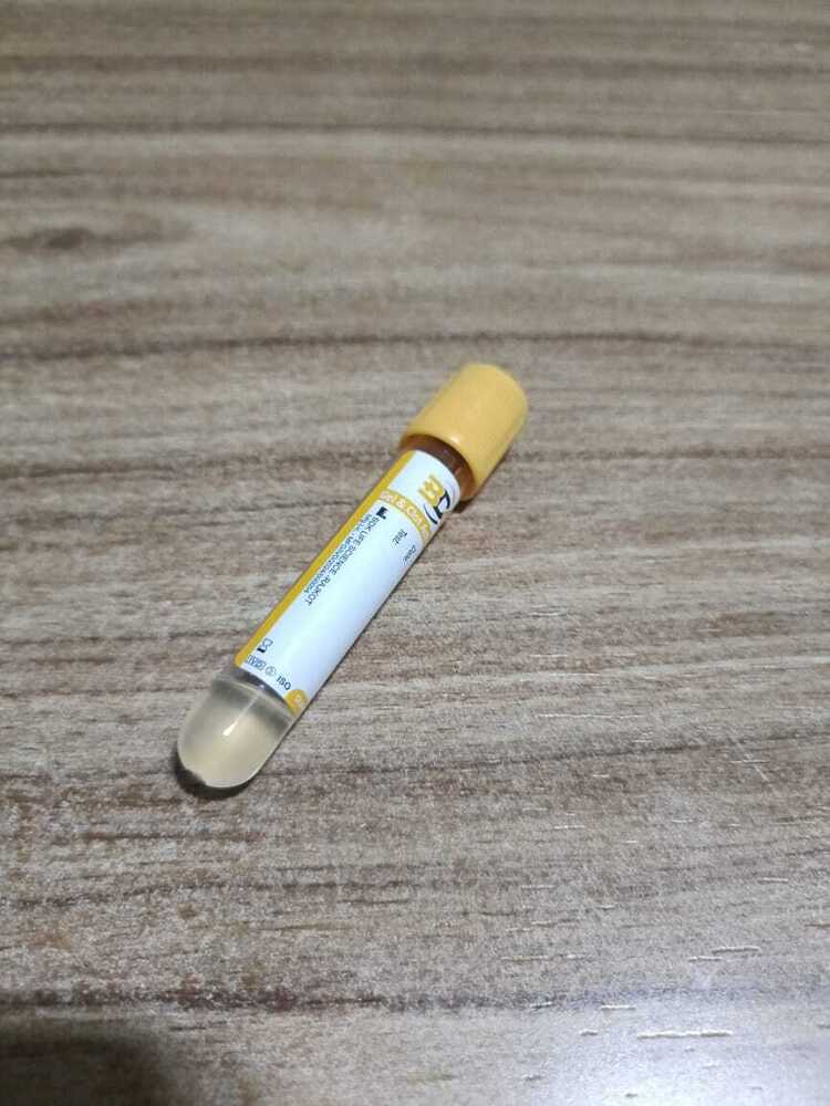 Gel+Clot Activator Vacuum Tube - Attributes: Sterilized
