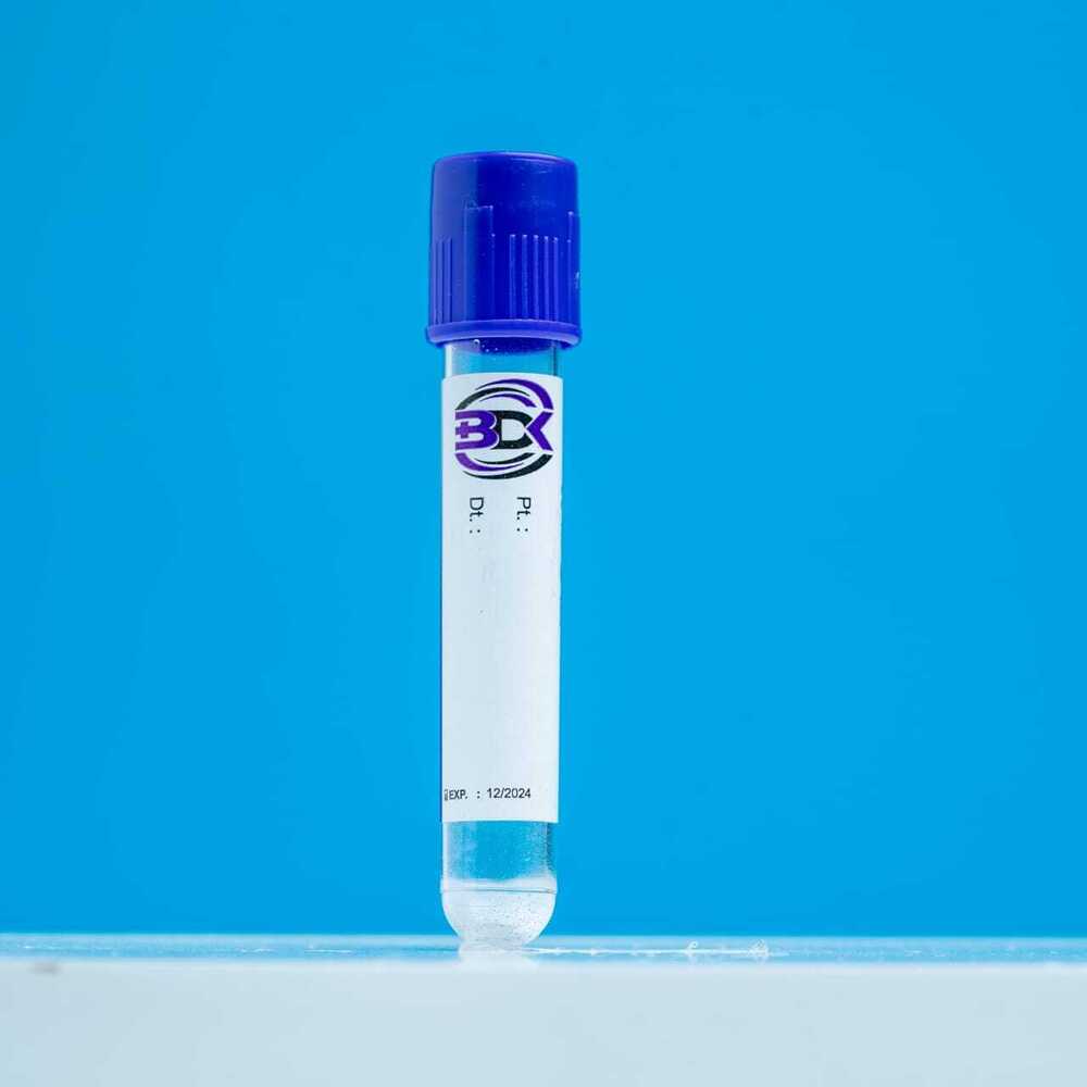 K3Edta Non Vacuum Tube - Attributes: Sterilized