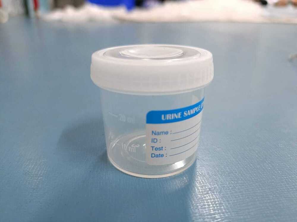 30ml Non Sterile Urine Sample Container
