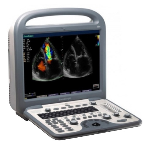 Sonoscape S8 Portable Ultrasound Machine