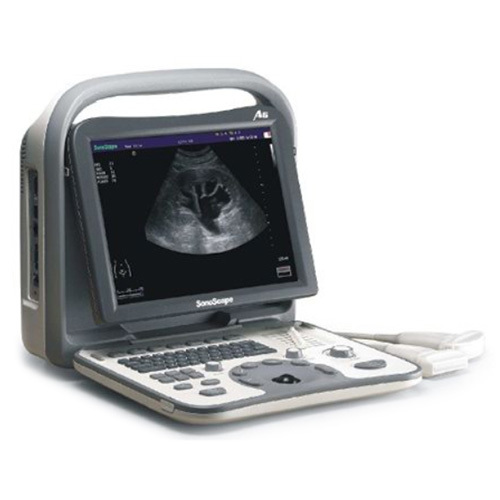 Sonoscape A6 Ultrasound Machine