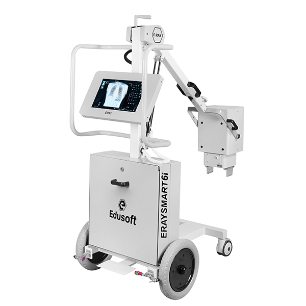 Mobile Digital Radiography System - Power Consumption: 125 Kilovolt-Amp (Kva)