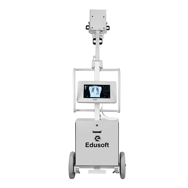 Integrated Digital Mobile X-ray (6kw) (100ma) - Frequency: 50 Hertz (Hz)