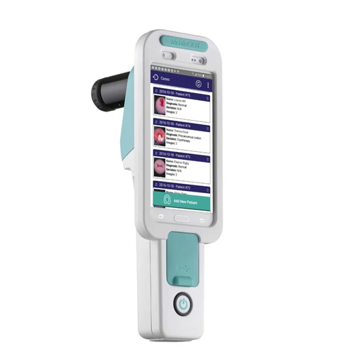 Ai Cervical Screening - Frequency: 50 Hertz (Hz)