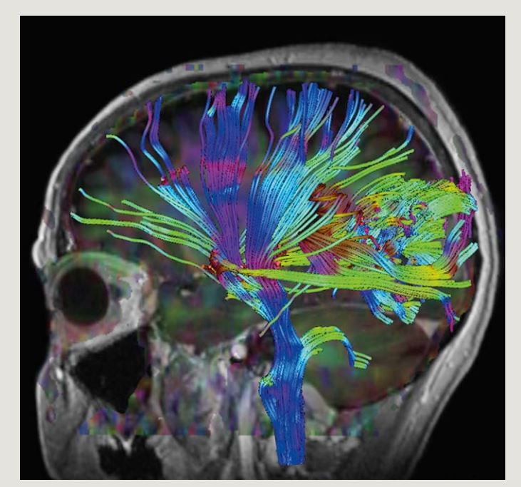 DI-HL Fuji Medical Dry Imaging Film