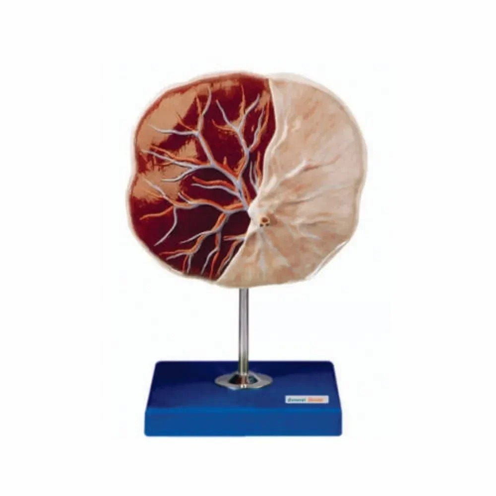 Human Pla-Centa Model - Color: Multicolor