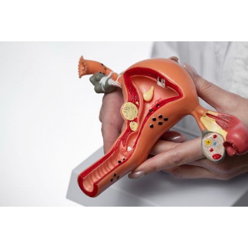 Uterus Ovary Model - Application: Institutional Use