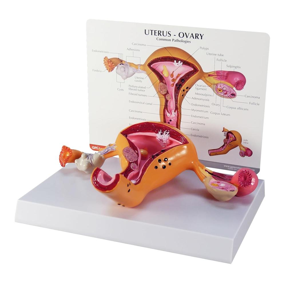 Uterus Ovary Model