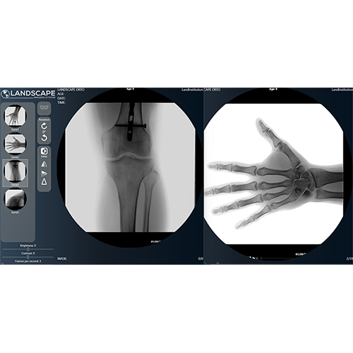 Eco Digital Mobile C-Arm ERAY SMART 5C