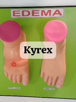 Kyrex Human Edema Model - Material: High Grade Pvc