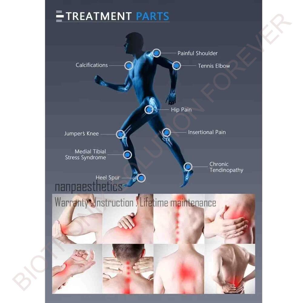 Focused Extracorporeal Shockwave Therapy Equipment for Physical Therapy