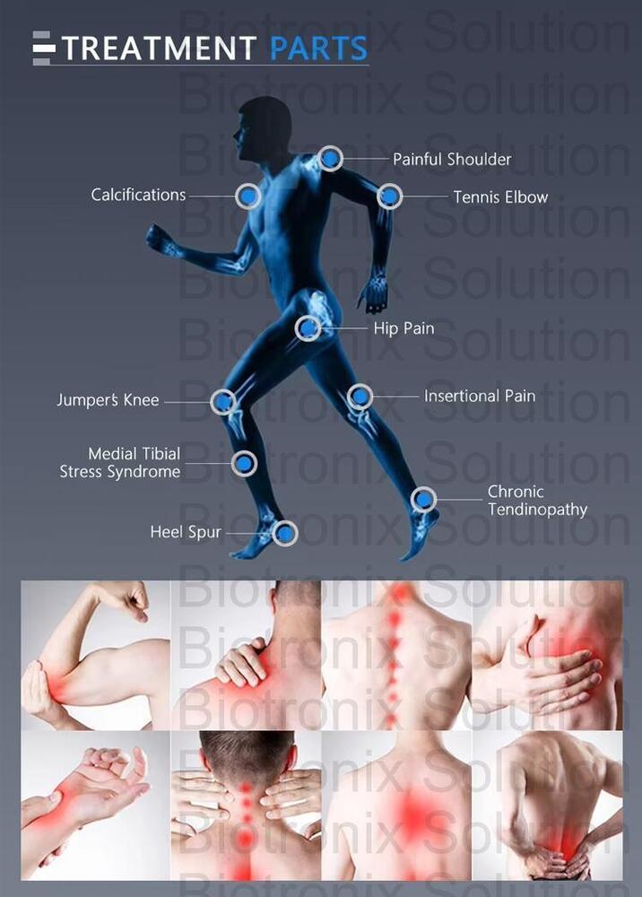 Advanced Focused Shockwave Therapy Machine for Back and Shoulder Pain Relief