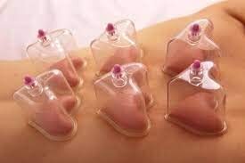 Star & Heart Shape Cupping Set (10Pc) - Age Group: Women