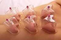 Star & Heart Shape Cupping Set (10pc)