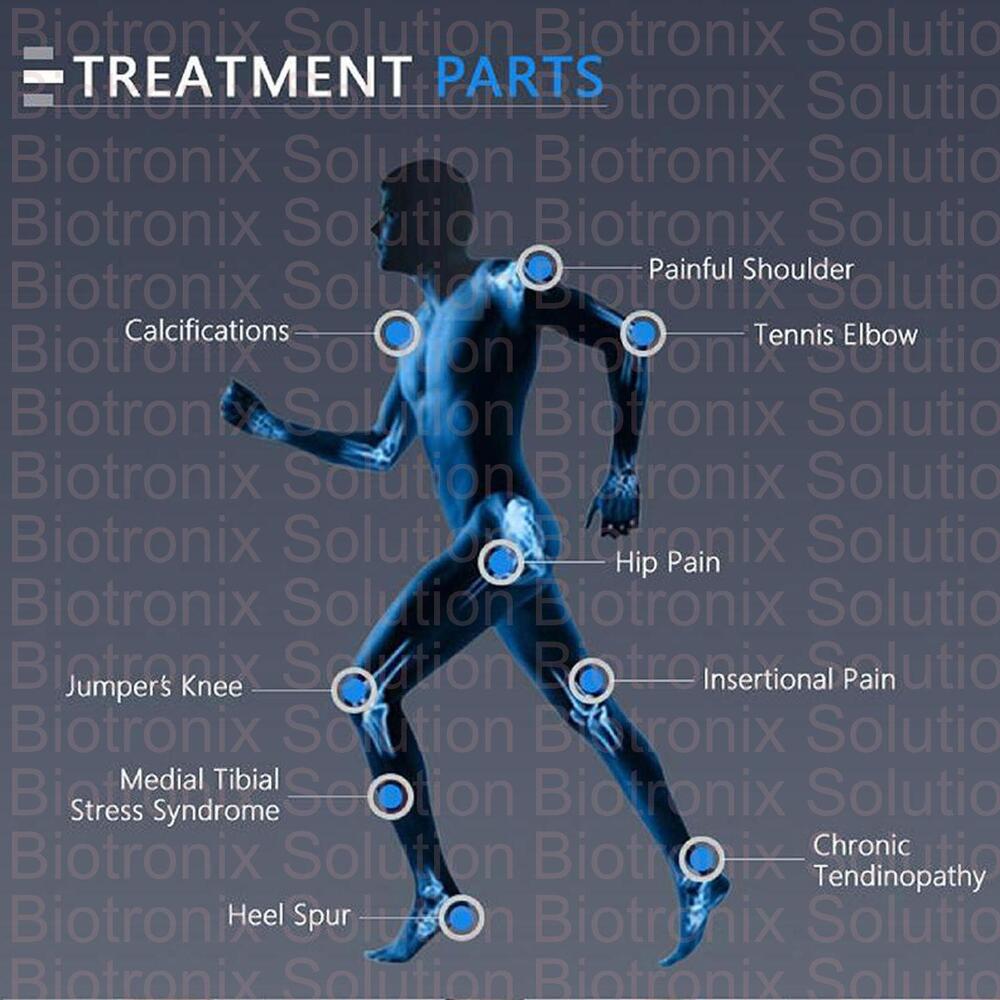 Portable Focused ESWT Machine for Muscle Regeneration and Pain Reduction