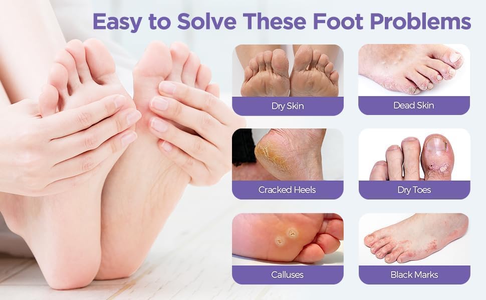 Foot Mask - Color: Multy