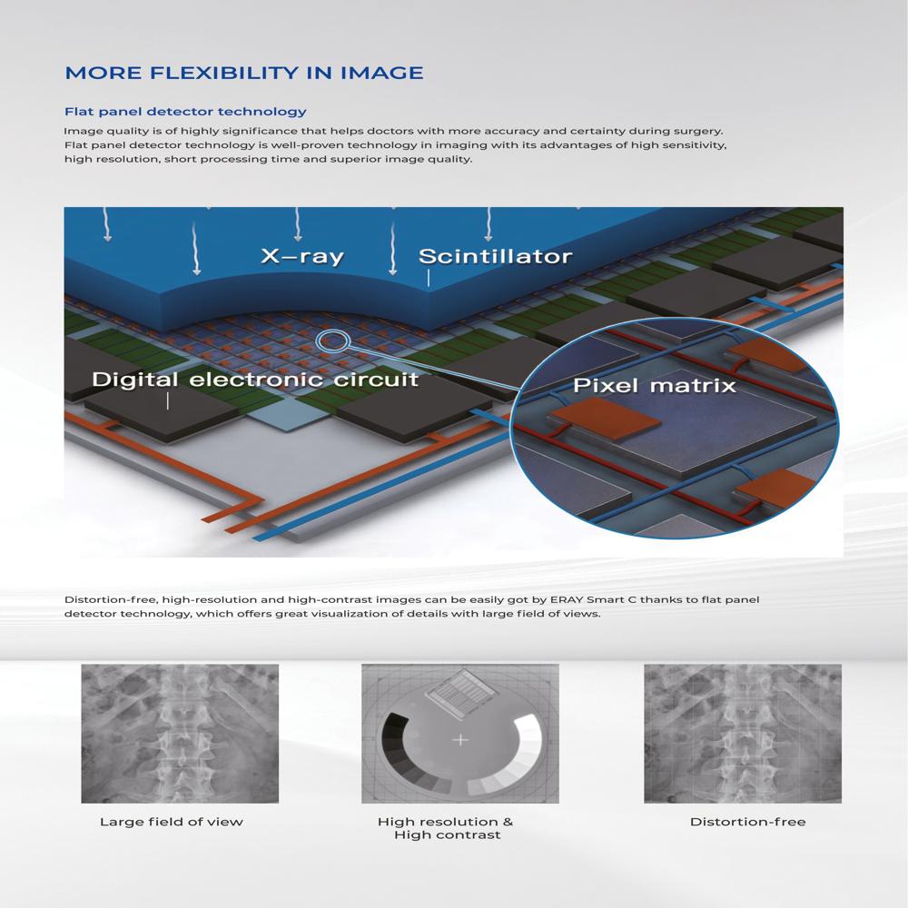 Flat Panel Based Mobile C-arm X-ray System - Color Code: White