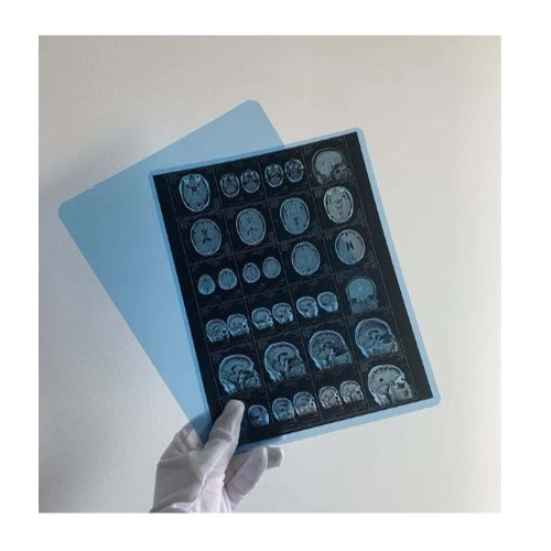 X-Shield X-Ray Inkjet Pet Films