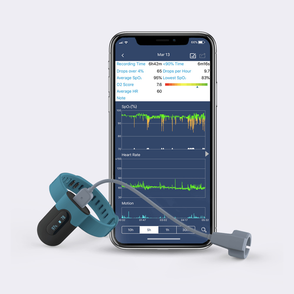 Sleepu Wrist Oxygen Monitor - Accuracy: 99 %