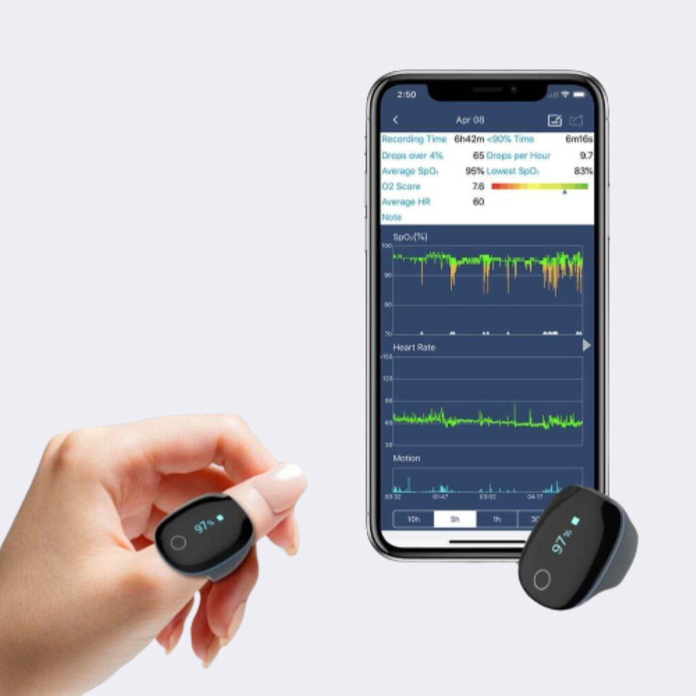 O2Ring Continuous Ring Oxygen Monitor - Automation Grade: Automatic