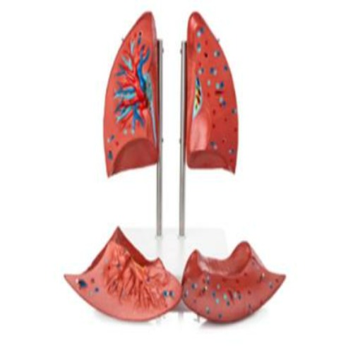 Lung model 