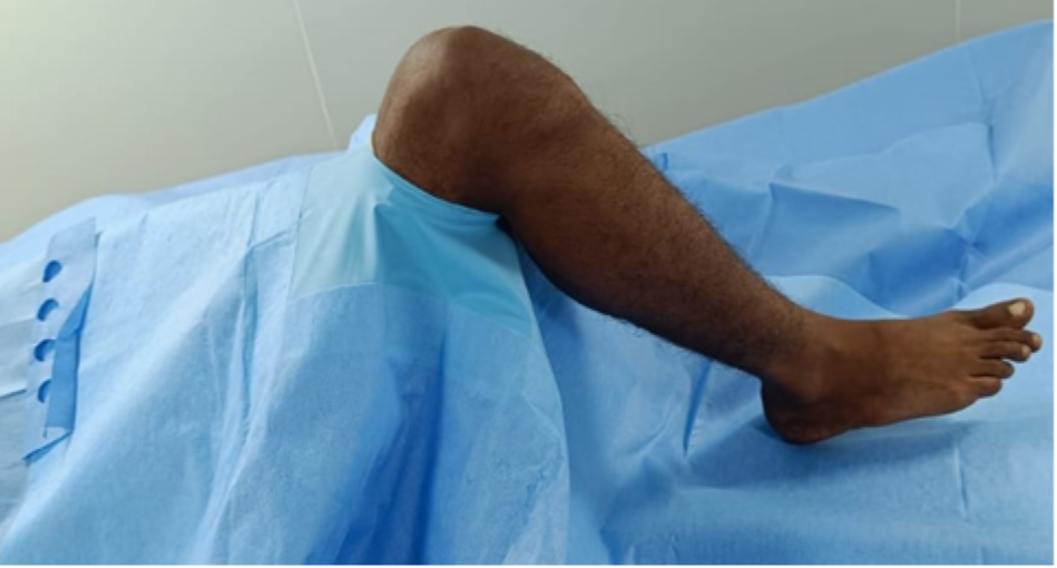 Knee O Drape - Color: Blue