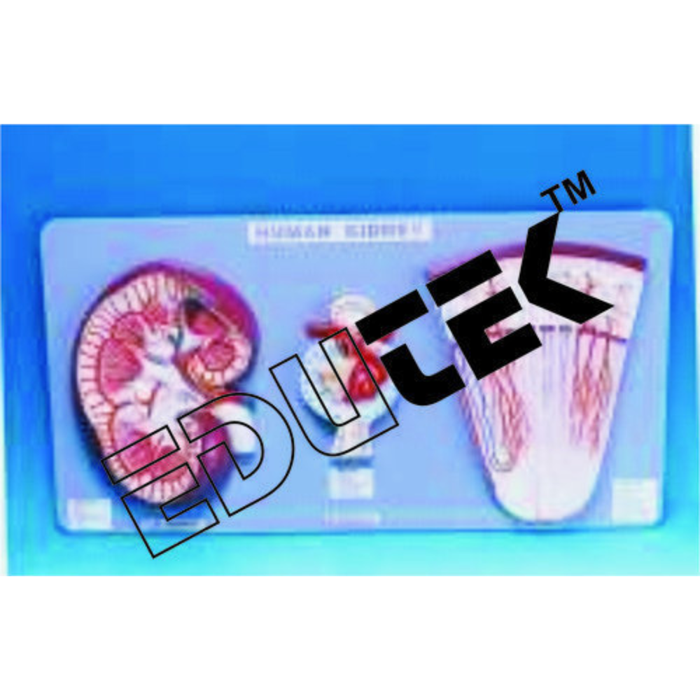 Kidney Section Nephrons