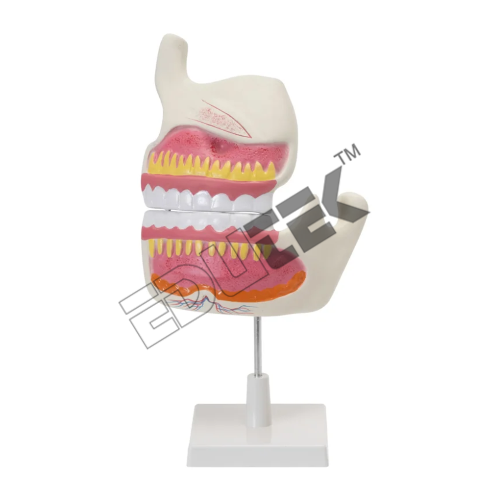 Human Upper and Lower Jaw