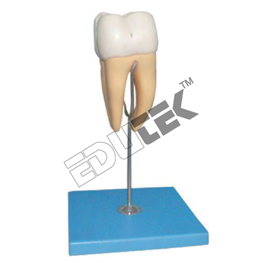 Human Tooth Models - Plastic Acrylic, Dissectable Six Parts, Removable Pulp & Caries Inserts, Educational Display Model With Key Card