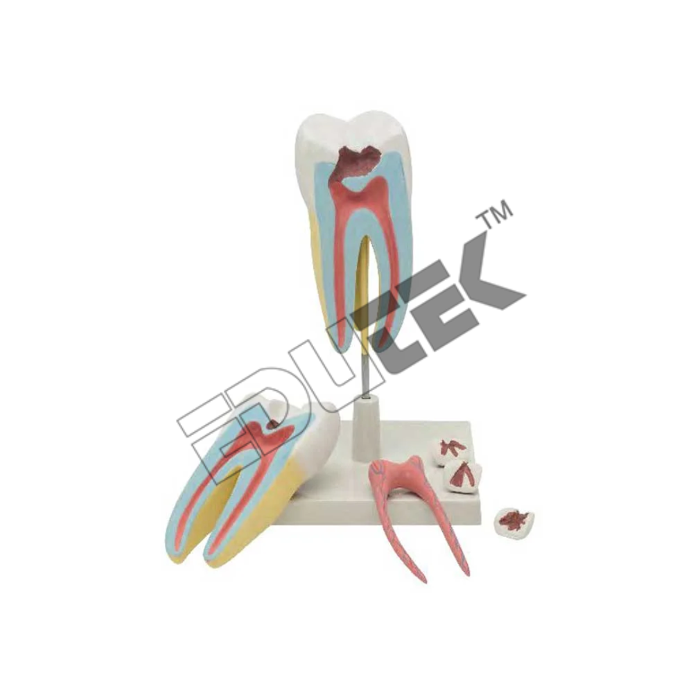 Human Tooth Molar
