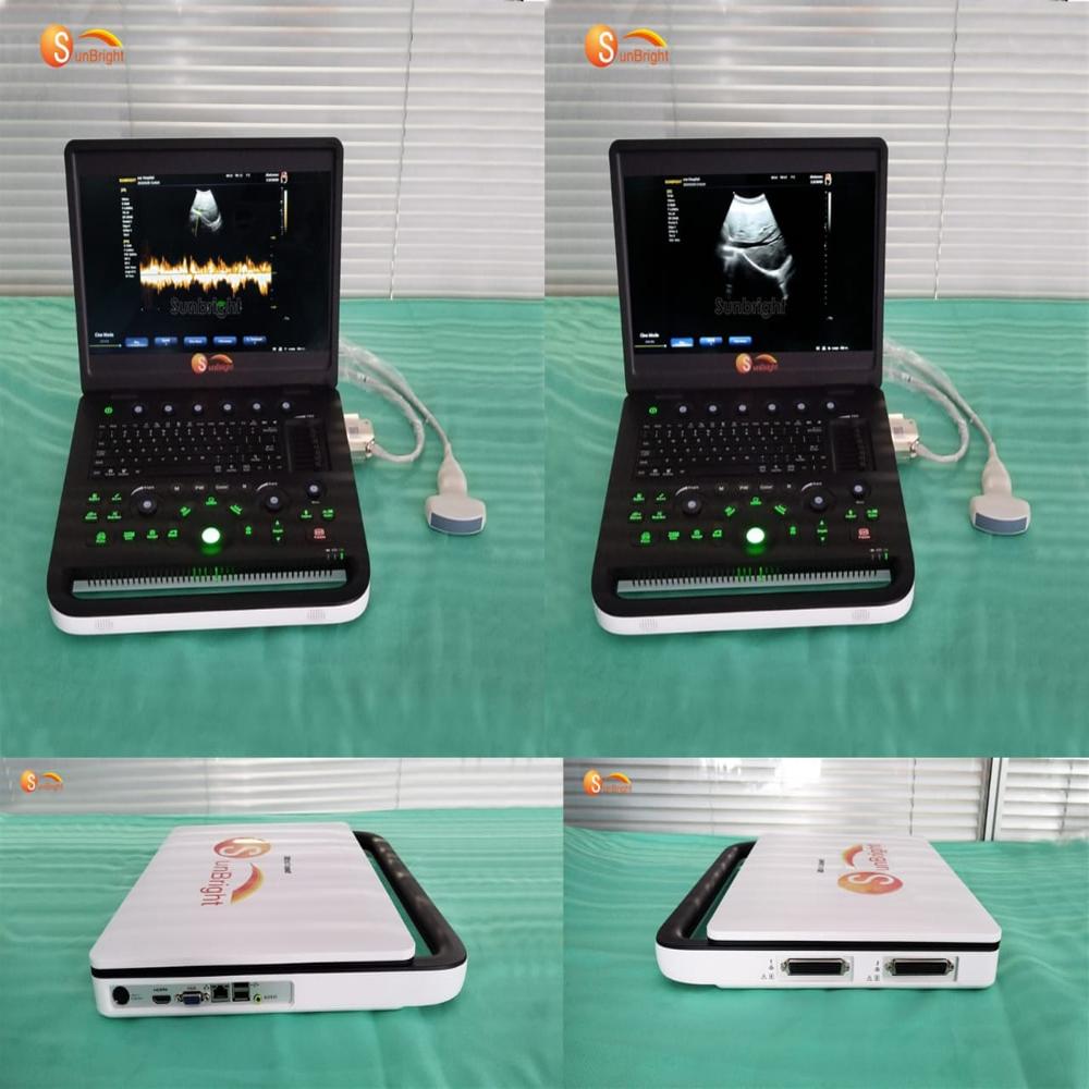 Human Ultrasound SUN-800C