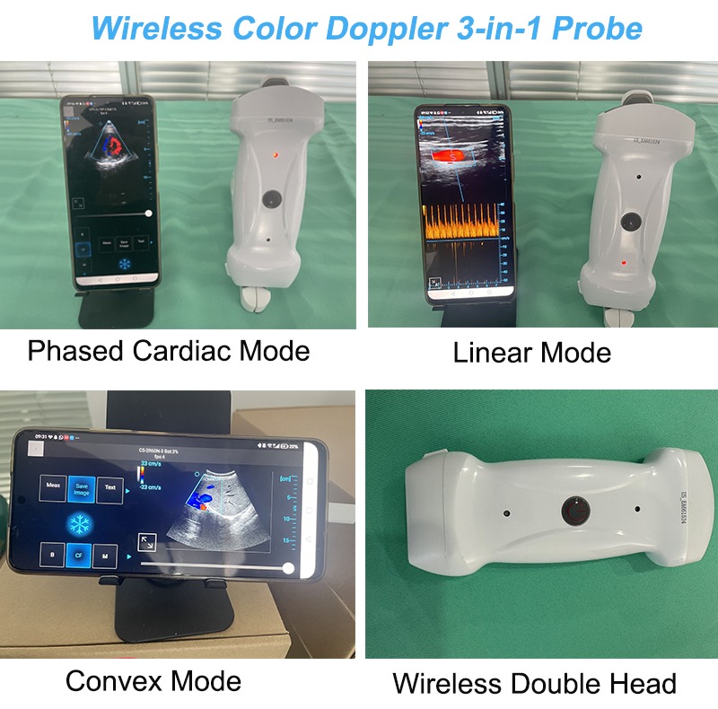 Wifi Ultrasound Probe Sun-c1 - Attributes: Strong & Durable